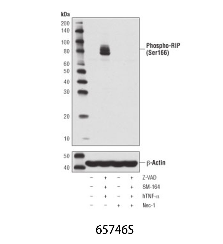 Phospho-RIP (Ser166) (D1L3S) Rabbit mAb