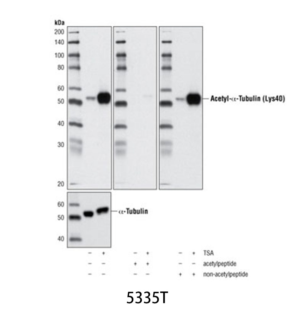 Acetyl-α-Tubulin (Lys40) (D20G3) XP Rabbit mAb