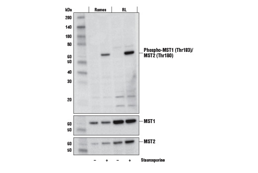 Phospho-MST1 (Thr183)/MST2 (Thr180) (E7U1D) Rabbit mAb