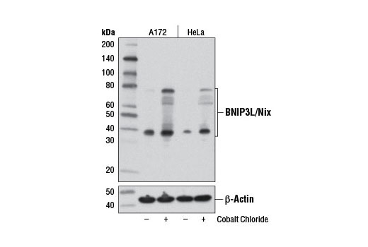Mitophagy Antibody Sampler Kit