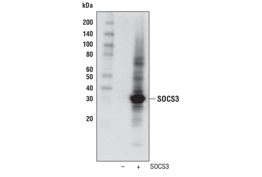 SOCS3 (D6E1T) Rabbit mAb
