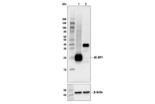 4E-BP1 (53H11) Rabbit mAb