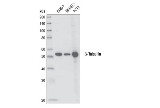 β-Tubulin (9F3) Rabbit mAb