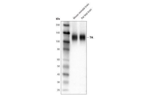 Trk (pan) (A7H6R) Rabbit mAb