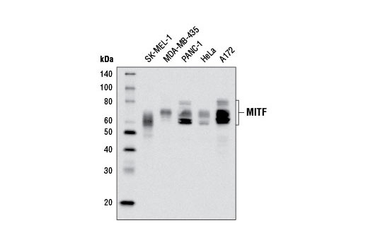 MITF (D5G7V) Rabbit mAb