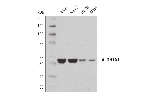 ALDH1A1 (D9J7R) XPRabbit mAb