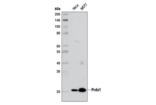 Prdx1 (D5G12) Rabbit mAb