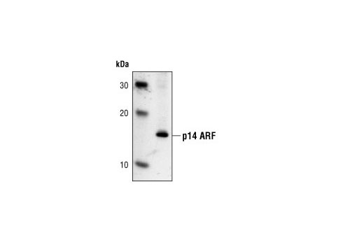 p14 ARF (4C6/4) Mouse mAb