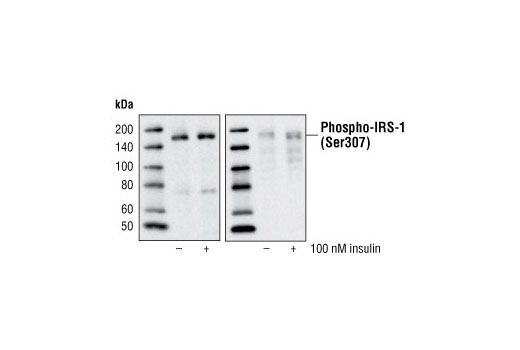 Insulin Receptor Substrate Antibody Sampler Kit