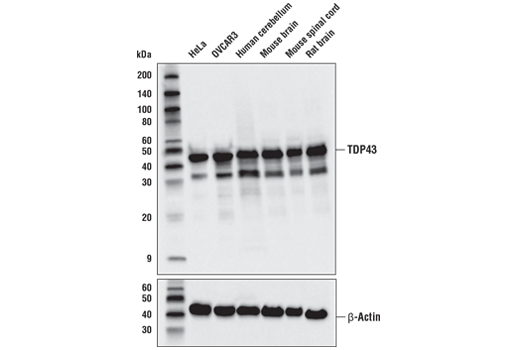TDP43 (D9R3L) Rabbit mAb