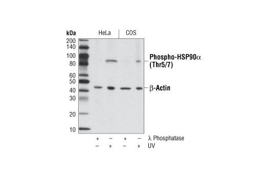 Phospho-HSP90α (Thr5/7) Antibody