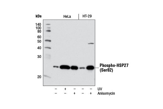 Phospho-HSP27 (Ser82) (D1H2F6) XP Rabbit mAb