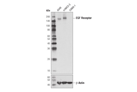 EGF Receptor (D1D4J) XP Rabbit mAb