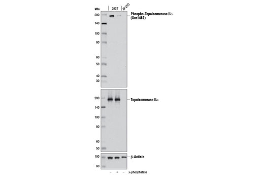Phospho-Topoisomerase IIα (Ser1469) (D4F5) Rabbit mAb