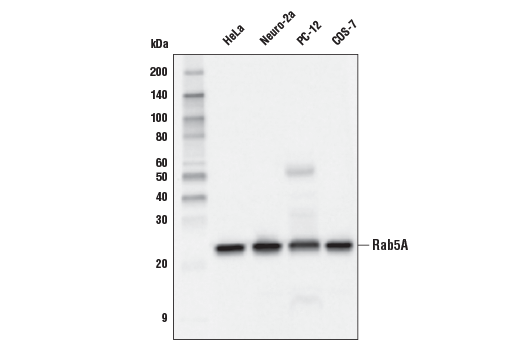 Rab5A (E6N8S) Mouse mAb