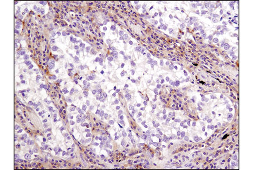 LKB1 (D60C5F10) Rabbit mAb (IHC Formulated)