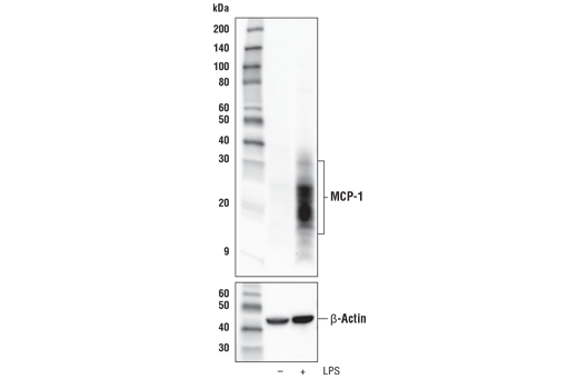 MCP-1 (E9R7Z) Rabbit mAb