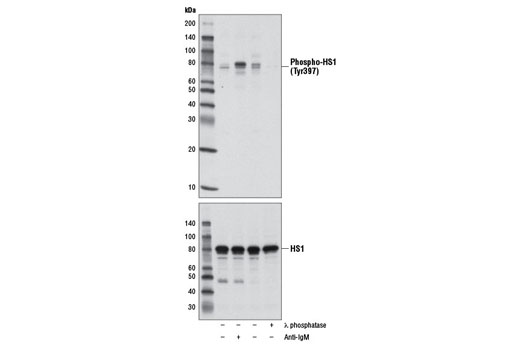 Phospho-HS1 (Tyr397) (D12C1) XPRabbit mAb