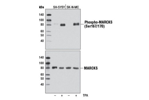 Phospho-MARCKS (Ser167/170) (D13E4) XP Rabbit mAb
