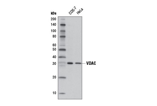 VDAC (D73D12) Rabbit mAb (HRP Conjugate)