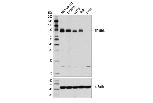 FRMD6 (D8X3R) Rabbit mAb