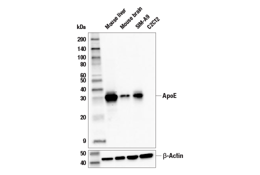 ApoE (E7X2A) Rabbit Monoclonal Antibody