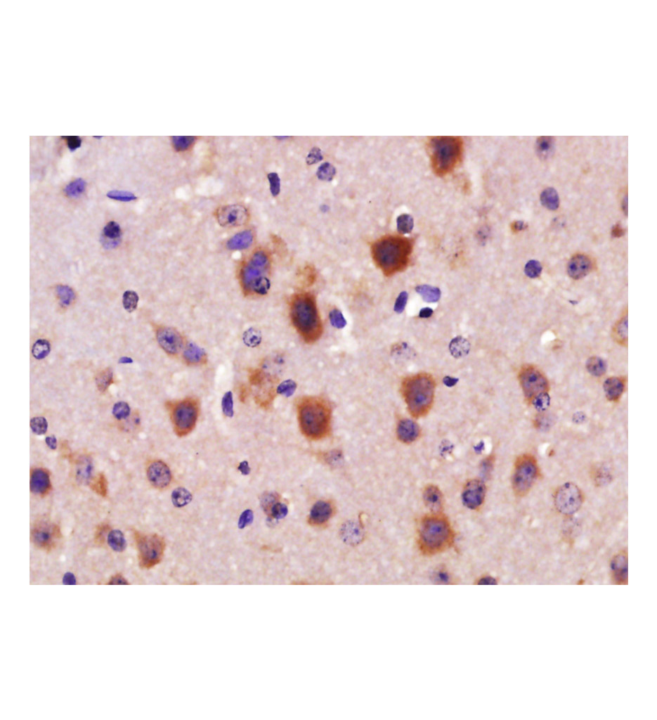 雄激素受体抗体