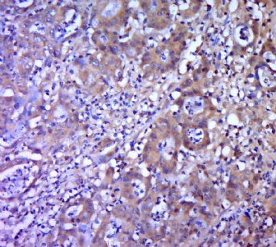 基质金属蛋白酶2抗体