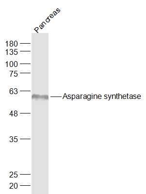 天冬酰胺合成酶