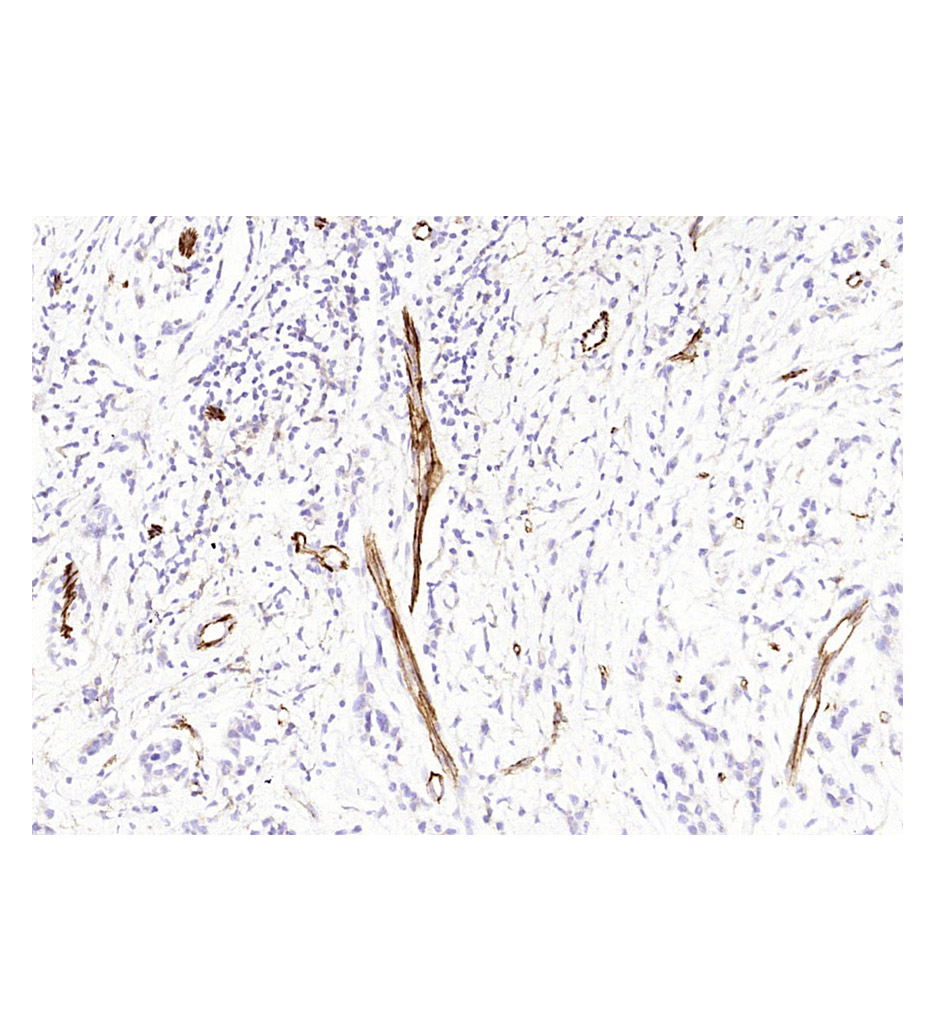 CD31单克隆抗体（工作液）