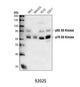 p70 S6 Kinase Antibody