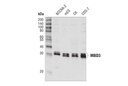 MBD3 (D1B8F) Rabbit mAb