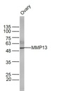 基质金属蛋白酶13抗体