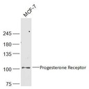 孕激素受体抗体